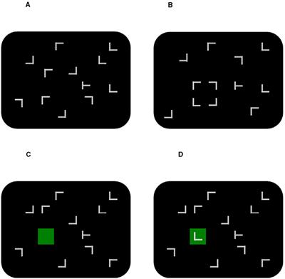 The effect of task-irrelevant objects in spatial contextual cueing